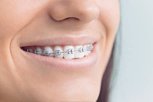 Best Dentures (Full and Partial)  in Chester, IL